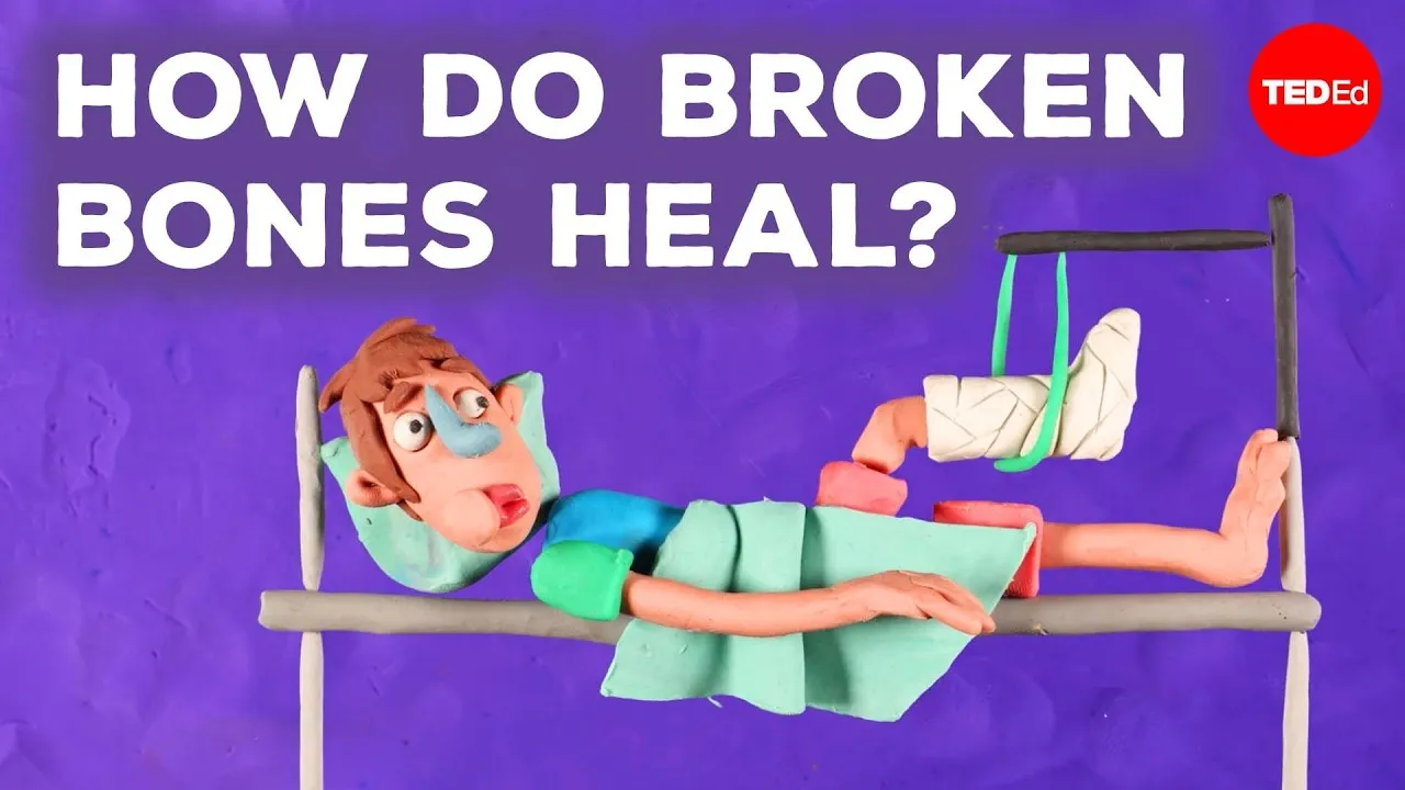 How Broken Bones Heal: A Step-by-Step Guide