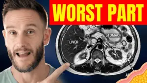 Shed Belly Fat, Sharpen Your Mind: The Brain-Gut Connection