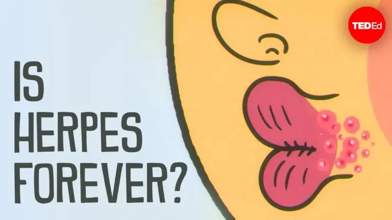 Understand Herpes: Causes, Symptoms, and Treatment Options