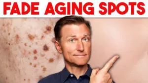 Unveiling the Truth: Age Spots Aren’t Just About Aging