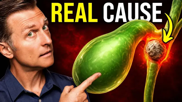 Low-Fat Diets May Trigger Gallstones, Not Fat